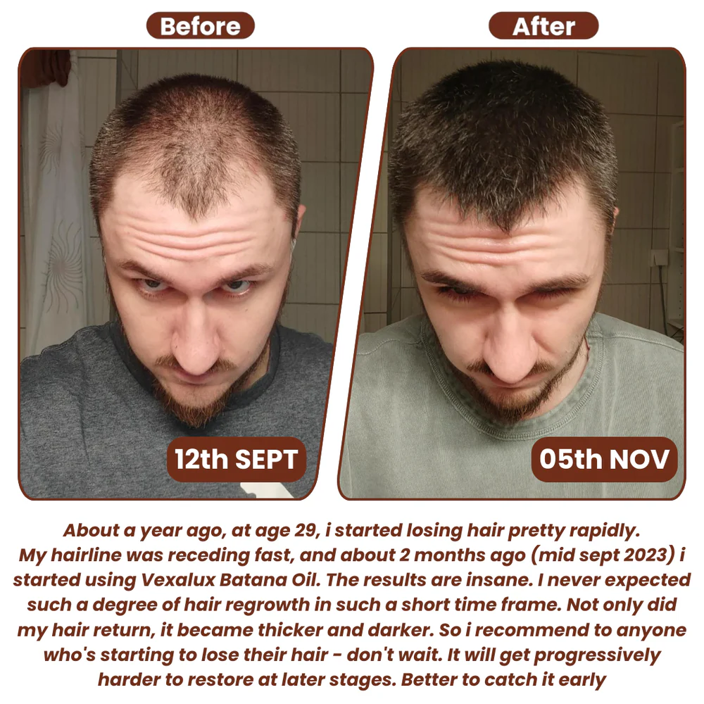 Grows Pure Batana Oil